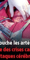 fumer-tue-16