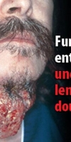 fumer-tue-4