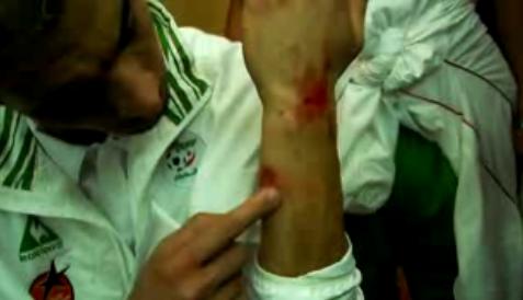 Le bus de l’équipe de football d’Algérie attaqué à son arrivée au Caire (VIDEO)