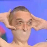 L&rsquo;homme à la peau hyper-élastique (VIDEO)