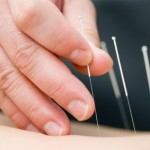 42 aguilles à coudre retrouvées dans le corps d&rsquo;un enfant de deux ans