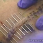 Nouveau record du monde : 1200 piercings en 4 heures (VIDEO)