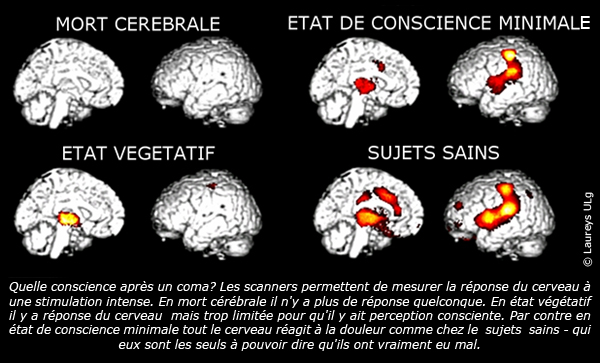 adolescente croate coma