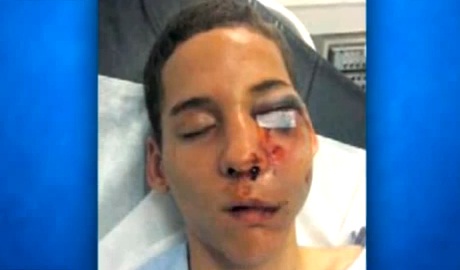 Un lycéen blessé par un tir de flashball à Montreuil (VIDEO) (réactualisé)
