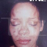 Rihanna : nouvelles photos chocs après son agression par Chris Brown (PHOTOS)