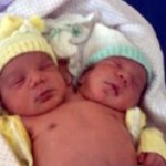 Naissance d&rsquo;un bébé à 2 têtes au Brésil (VIDEO)