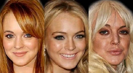L’évolution du visage de Lindsay Lohan en 60 secondes (VIDEO)