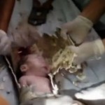 Chine : L’incroyable sauvetage d’un bébé tombé dans un conduit de WC (VIDEO)