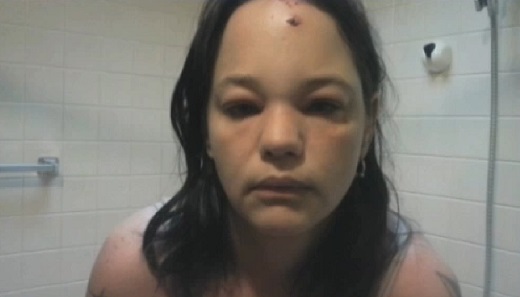 Une femme violemment attaquée par… un chat (VIDEO)