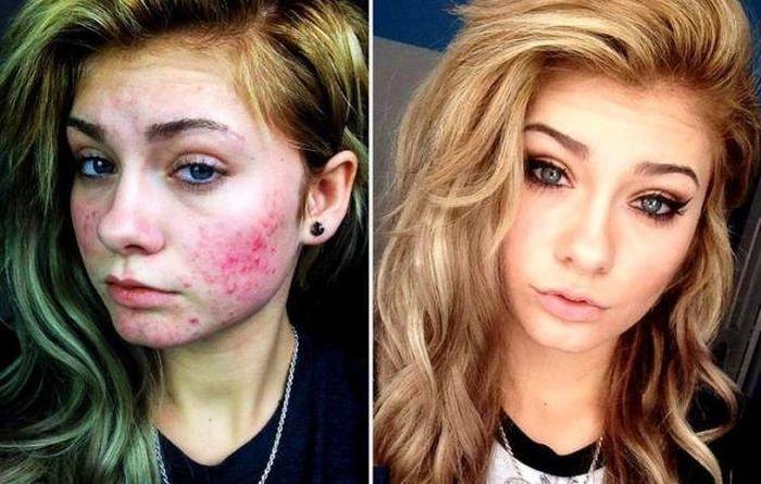 Problèmes de peau : quand le maquillage fait des merveilles (22 photos)