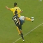 Oh mes burnes !!! (VIDEO)