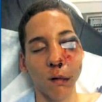 Un lycéen blessé par un tir de flashball à Montreuil (VIDEO) (réactualisé)