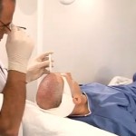 Le mystère de la calvitie enfin élucidé ? (VIDEO)