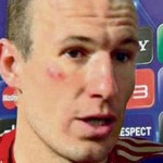 Une bagarre entre Ribéry et Robben dans le vestiaire !