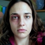 Une femme battue se prend en photo tous les jours pendant un an (VIDEO)