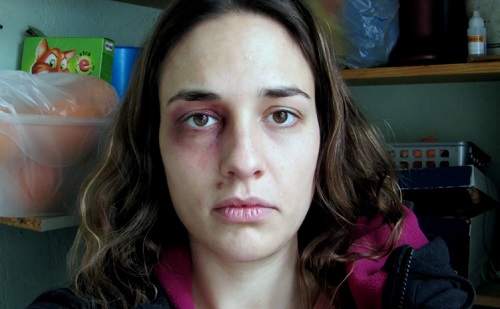 Une femme battue se prend en photo tous les jours pendant un an (VIDEO)