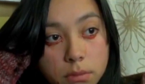 Chili : Elle pleure des larmes de sang (VIDEO)