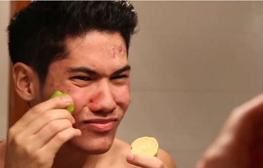 Tout sur l&rsquo;acné par Aziatomik (VIDEO)