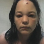 Une femme violemment attaquée par… un chat (VIDEO)