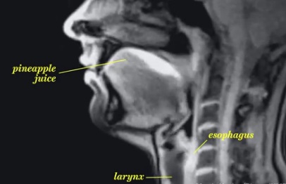 Le corps humain et la vie en version IRM (vidéo)
