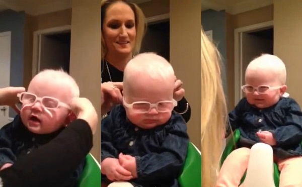 Atteinte d’albinisme, une fillette voit sa mère pour la première fois (vidéo)